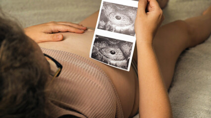 Expectant Parent with Ultrasound Scan. A pregnant person is seen holding an ultrasound scan over...