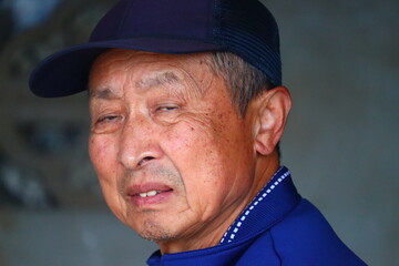 出っ歯　シニア男性　くしゃみ