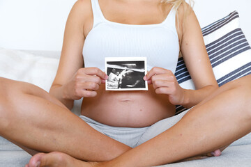 Unrecognized Female Hold The Scan Of The Baby's Ultrasound, Sitting At Home On The Couch. Concept...