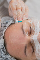 Beauty anti-aging injections biorevitalization face mesotherapy. Cosmetologist doctor making needle...