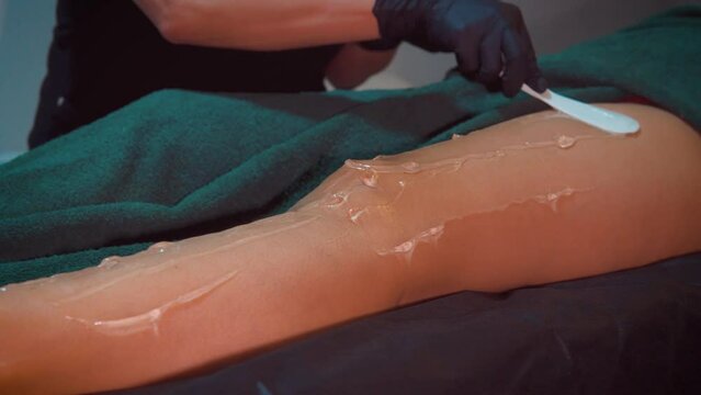 Leg hair removal treatment, medical woman applies body hair removal process.