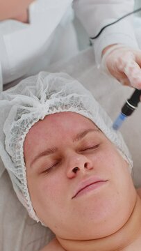 Peeling, woman health care, skin regeneration, dermapen microneedling, dermastamp. Beautician cosmetologist doing forehead face procedure fractional microneedle mesotherapy clinic facial rejuvenation