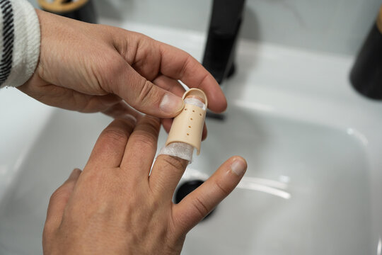 Hand Injury Care at Home. Anonymous man carefully adjusts or removes finger splint for injured hand in the comfort of his home.