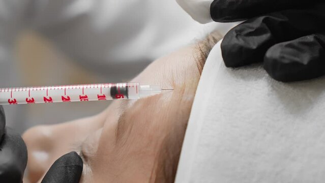 A closeup photo captures a cosmetic injection procedure on the forehead performed by a professional wearing black gloves. The scene exudes precision and care in the beauty treatment process