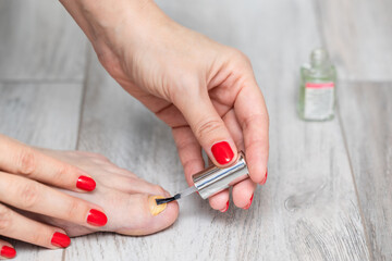 woman applying strengthening varnish to her big toe nail.  nail fungus. toenail disease. woman...