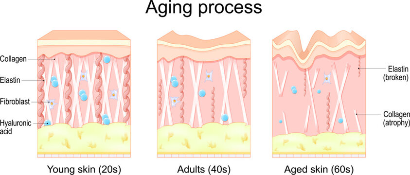 Aging process in the skin