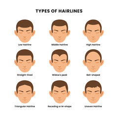 Set different types of hairlines poster with  low, middle, high, straight-lined, widow's peak, bell-shaped,triangular, receding, m-shaped, uneven. Beautiful hairstyle, trendy haircut fashion barber.