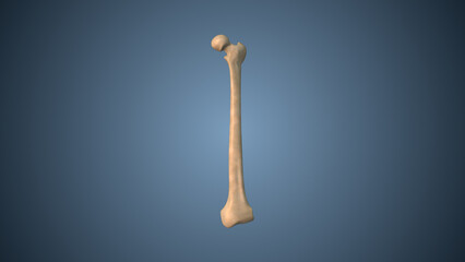 Medical Concept of Cracked Bone Or Bone Fracture