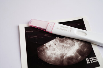 Pregnancy test with ultrasound scan photo of fetus, maternity, childbirth, birth control.