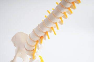 Fototapeta premium Spinal nerve and bone, Lumbar spine displaced herniated disc fragment, Model for treatment medical in the orthopedic department.