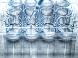 Medical sample beingpipetted into microplate
