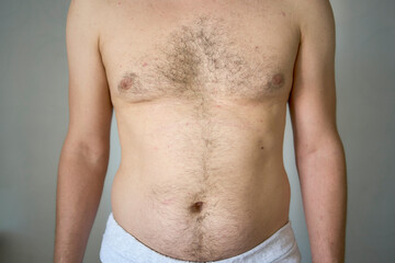   chest and stomach of a thirty-year-old with average build