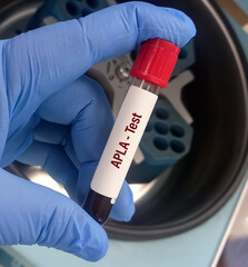 Blood Sample tube for APLA (Anti phospholipid antibodies) test, to diagnosis of Antiphospholipid...