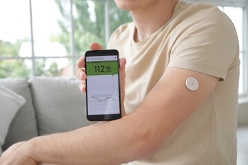 Diabetic young man with glucose sensor and mobile phone training at home, closeup