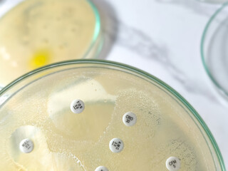 Antibiotic susceptibility testing,  antibiotic resistance.