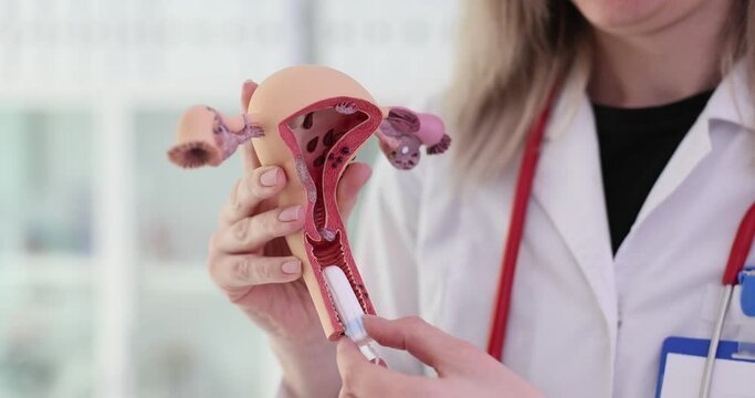 Female gynecologist demonstrates model of female reproductive system and hygienic tampon