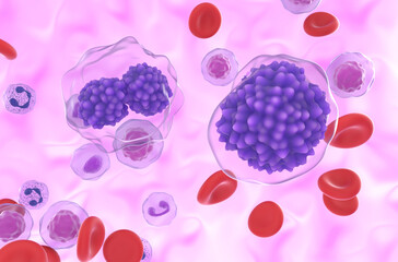 Plasma cell leukemia (PCL) - closeup view 3d illustration