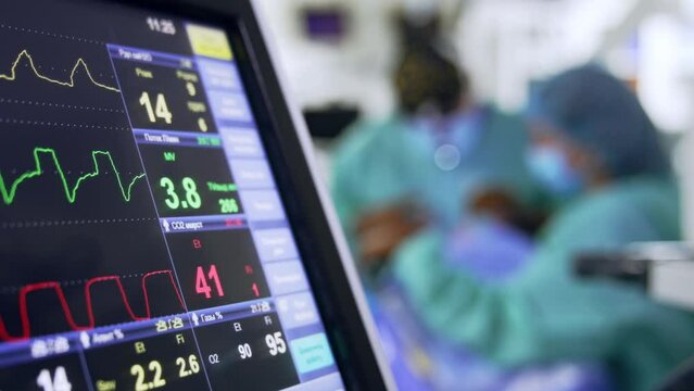Part of the screen at lung ventilating machine. Display of the patient's life parameters during surgery. Doctors work at backdrop in blur.