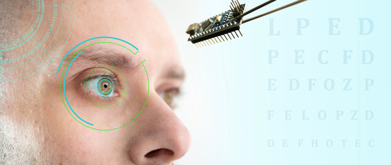 Installing electronic chip into human bionic, neuroprosthetic eye, cutting-edge technology,...