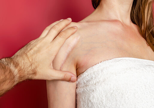 Man hand examines postoperative scar on woman shoulder. Healing of scars, treatment of scars on the skin