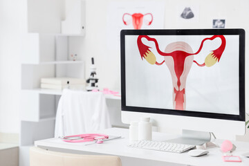 Computer monitor with picture of uterus on table in gynecological office