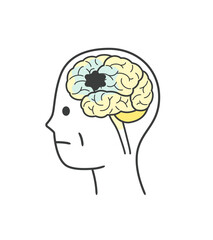 脳血管性認知症によって損傷を受ける脳の部分のイラスト