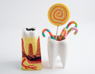 Tooth decay with sweet sugar candy, bad food for dental health care.