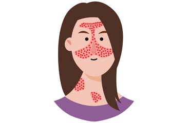 Discoid lupus erythematosus is a chronic skin condition causing red, inflamed, scaly patches. Similar diseases include systemic lupus erythematosus ,sick, subacute cutaneous lupus, and lichen planus.