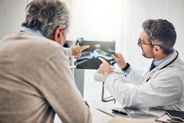Advice, man and doctor in office with xray, results and health insurance consultation at arthritis...