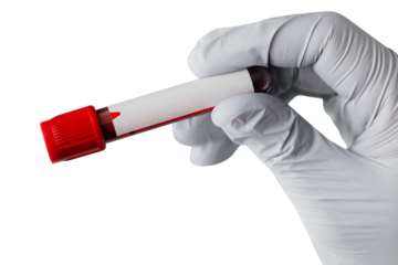 Doctor holding a blood test tube during coronavirus pandemic transparent png