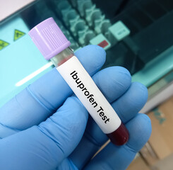 Ibuprofen. Blood sample in a container for analysis of Ibuprofen drugs test. drugs, trace elements...