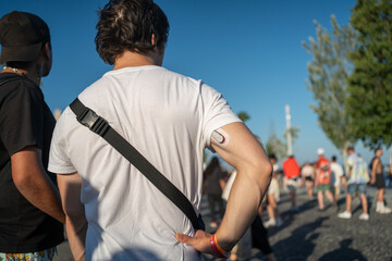 Rear view of anonymous male tourist with glucose monitoring system sensor on back of arm, standing...