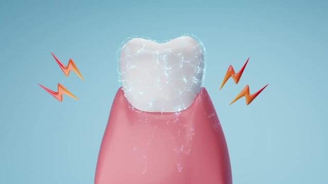 Sensitive teeth cause pain, like sparking sensation, in the teeth and gums.