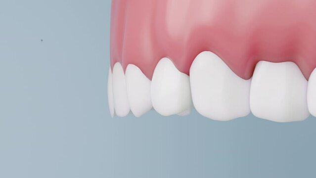 Toothpaste and fluoride protect teeth and gums from bacteria and disease