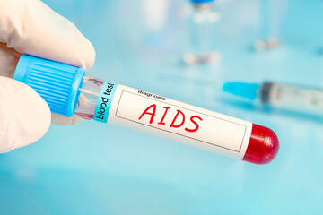 Doctor's hand holds test tube in blood on the background of test tubes with analyzes. Blood sample with HIV testing. blue laboratory background.
