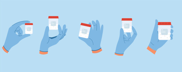 Set of illustrations with doctor hand in blue gloves hold semen analysis in plastic container