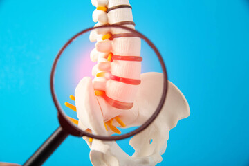 White mockup of the human spine on a blue background with a magnifying glass. Concept of diseases...