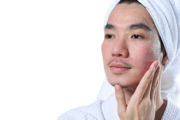 Young man in bathrobe applying moisturizer on his face carefully for rapid recovery after laser...