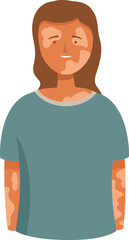Portrait of a happy female character with vitiligo, promoting body positivity and self acceptance