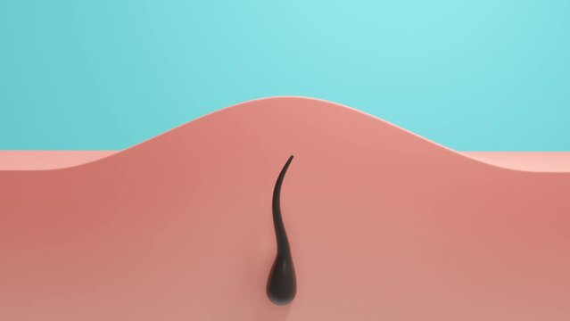 Ingrown hair with redness. Minimal modern motion design. Abstract animation