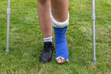Boy with a broken leg in a cast during a football match an injury to a young athlete