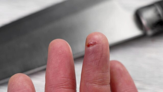 A cut finger from a kitchen accident. Hand injury or wound to the skin. Close up view and knife lying on the table. Danger of negligence concept