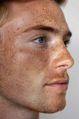 Fototapeta premium Before and After Photos of Pigmented Spots Removal on Man's Face Through Effective Laser Treatment