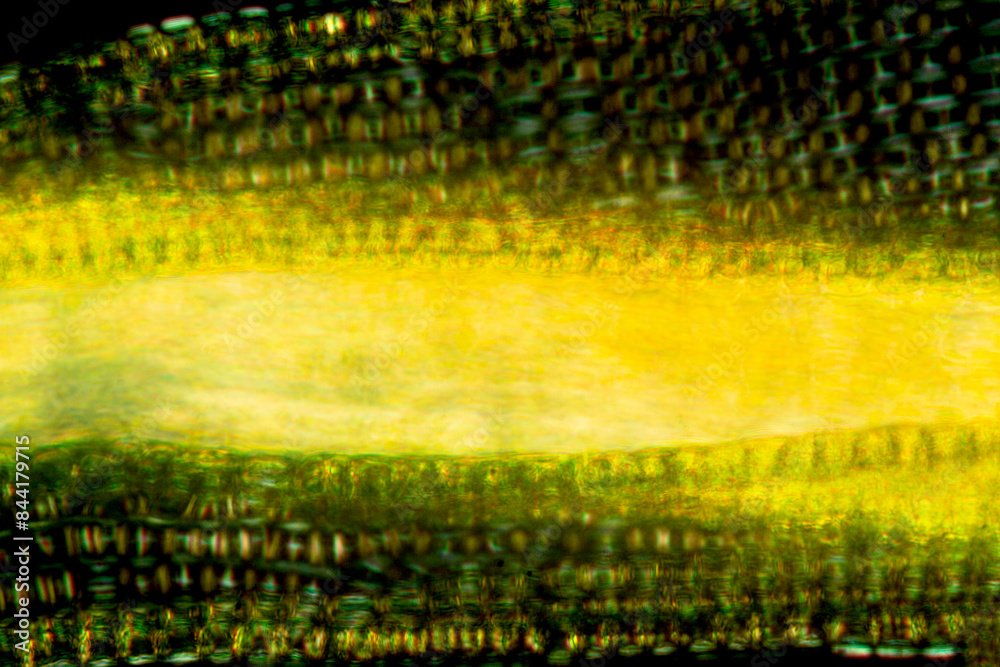 Poster Abstract micrograph of a moss leaf, with polarization.