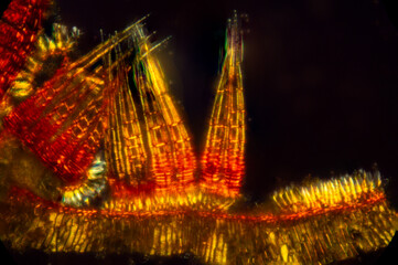 Peristome teeth of a whip fork moss, with polarization.