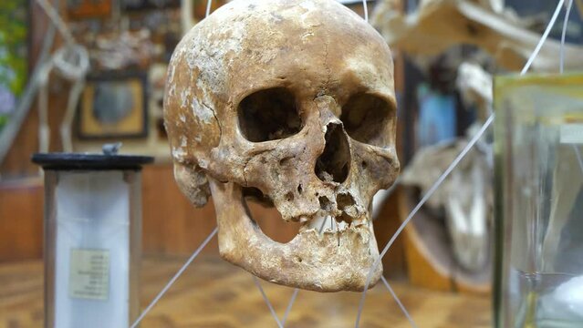 Human skull. Bones of human cranium