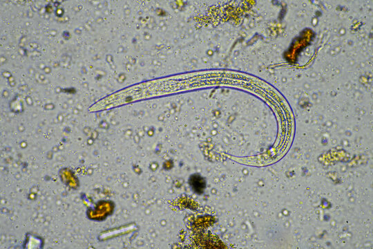 microorganisms under a microscope including amoeba, flagellates, nematodes, fungi, bacteria, viruses and diseases of animal and human health