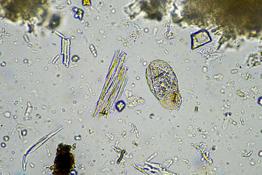 soil microorganisms under a microscope including amoeba, flagellates, nematodes, fungi, bacteria, from a soil sample on a regenerative agriculture farm in Australia