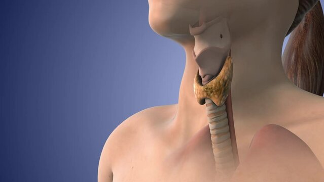 Thyroid gland cancer medical animation
