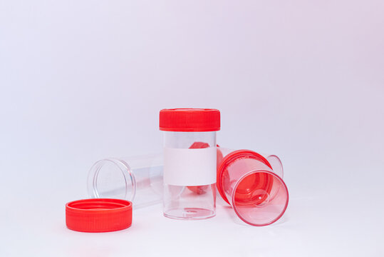 Flacon d'&eacute;chantillon &agrave; urine, flacon de laboratoire, r&eacute;cipient d'urine, analyses